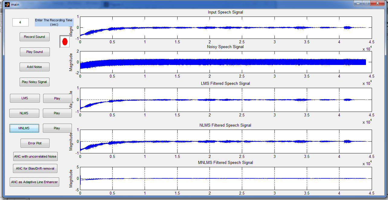 Audio Watermarking by DWT-SVD-BFO