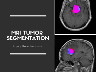 Brain Tumor Segmentation in MRI Images